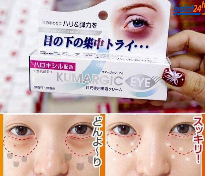 Kem mắt Kumargic – Trả lại đôi mắt tinh anh cho phái đẹp 8 kem mắt kumargic có tốt không
