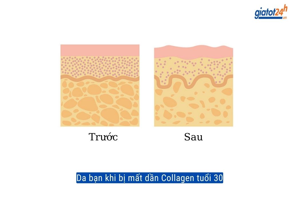 Dấu hiệu khi da bạn mất đi collagen