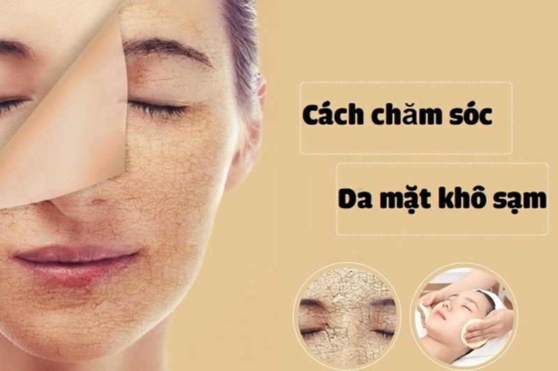 Cách chăm sóc da khô đúng cách để có làn da đẹp và căng mịn mỗi ngày