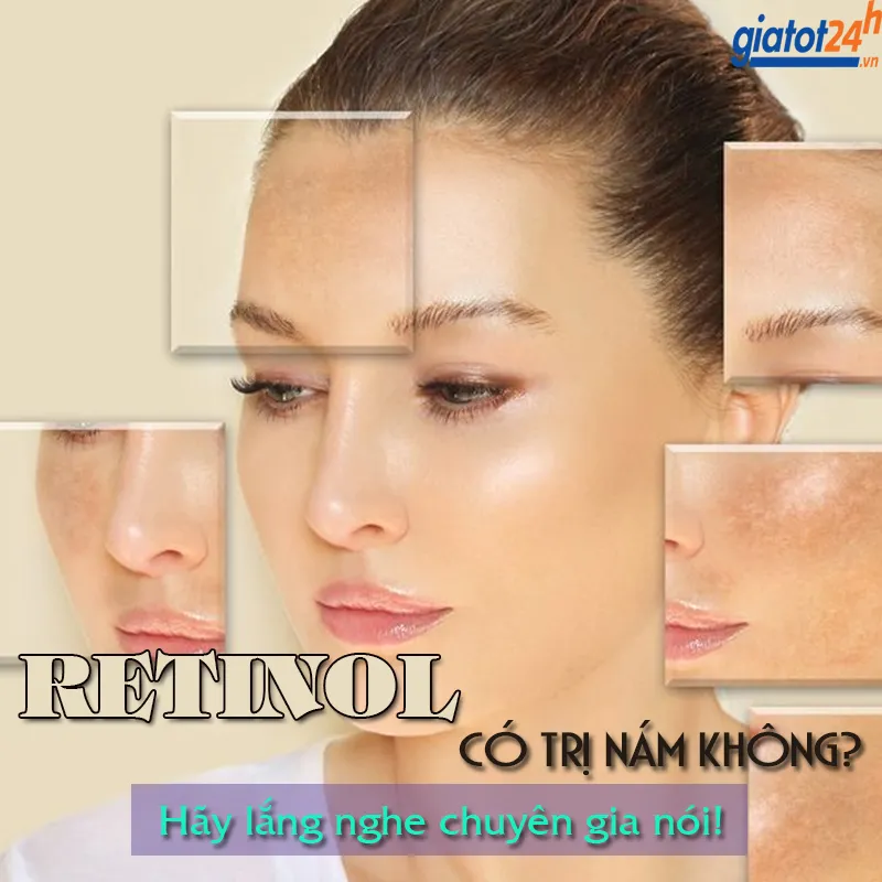 Retinol Có Trị Nám Không?