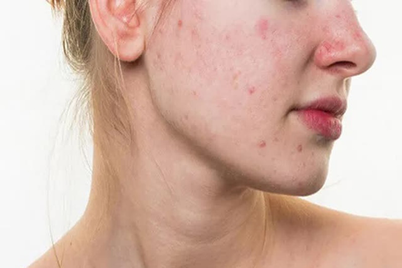 Những câu hỏi thường gặp về viên uống DHC vitamin C 6 uống dhc vitamin c nên luu ý gì