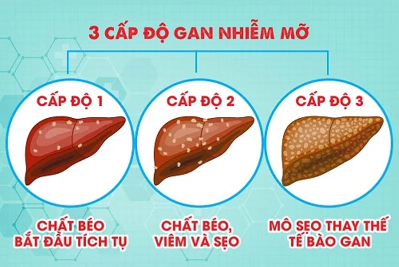 các bệnh về gan thường gặp