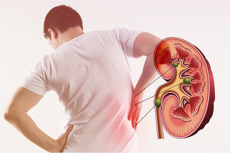 Nhận diện 8 dấu hiệu của bệnh suy thận và cách phòng ngừa 9 các dấu hiệu của bệnh suy thận