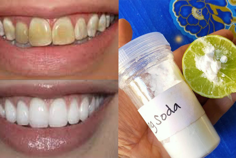 cách giữ trắng răng bằng sử dụng hỗ hợp chanh muối soda