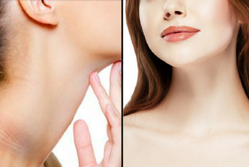 Da cổ bị sạm đen: nguyên nhân và cách điều trị hiệu quả 6 Da cổ bị sạm đen nguyên nhân do đâu