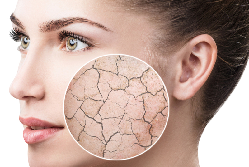 Nếu thiếu hụt collagen, cơ thể sẽ ra sao? 9 da khô là dấu hiệu thiếu collagen