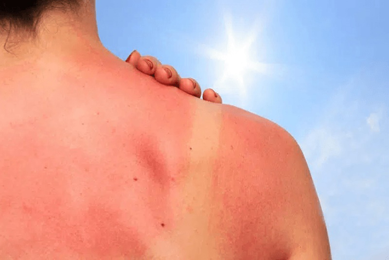 Da sạm sau sinh liệu có tự hết không? 8 da sạm sau sinh do đâu