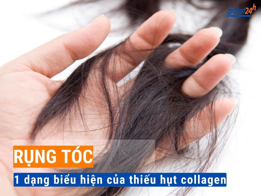Rụng tóc do thiếu hụt collagen